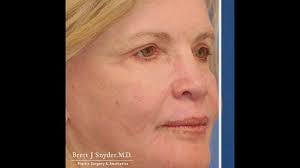 💥WE ARE OPEN!!💥 Introducing the newest addition to Solano Plastic  Surgery: 💉👄Bella Solano MediSpa! 💉👄 It's located