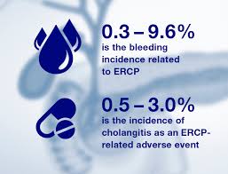 Within erebus, zagreus must partake in a perfect clear challenge. Ercp Endoscopic Retrograde Cholangiopancreatography Olympus Medical Systems