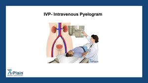 Image result for Intravenous Pyelogram