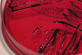 Xld agar is recommended in the iso 6579 testing of salmonella; Antibiotics 2021 On Twitter Salmonella Typhimurium Species Growing On Xld Agar Salmonellatyphimurium Xldagar Clinicalmicrobiologysummit Immunologygathering Edinburgh Scotland To Know More Https T Co Mauqptiqb8 Https T Co 5qmu6nx3r9