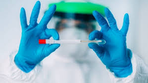 Sağlık kuruluşları, önce influenza testi yapıyor. Korona Test Sonucu Ne Zaman Cikar Korona Testi Ne Kadar