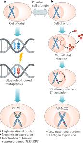 Image result for Merkel Cell Carcinoma