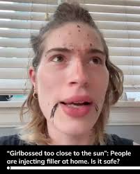 A syringe of facial filler, which can add volume to areas of the face that  appear sunken, can cost over $1,000 at a licensed provider. Now, some  people are skipping the professionals