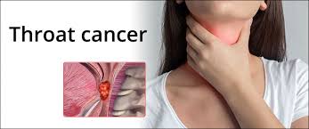 Your nurse will explain the type of cancer you have and the correct name. Throat Cancer Treatment In Jaipur Medical Oncologist Tarachand