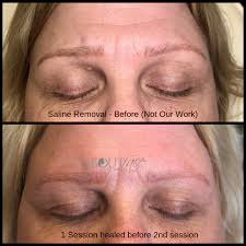 They must heal properly before you'll see the end result. Tattoo Removal Permanent Makeup Correction Results About Face And Body