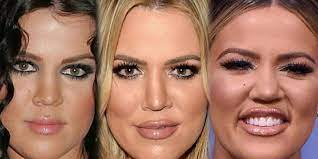 Inside Khloe Kardashian S Shocking Plastic Surgery Obsession You Could Rest A Drink On That Lip Khloe Kardashian Plastic Surgery Kardashian Plastic Surgery Khloe Kardashian