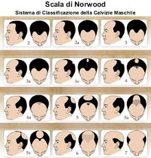 Un ragazzo su 5 (il 18% del campione di analisi) di età compresa tra i 12 e i 20 anni soffre di calvizie giovanile e quindi perdita dei capelli . Protesi Soluzione Alla Perdita Dei Capelli Nell Uomo Fair Fashion Blog