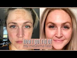 We did not find results for: Musely Face Rx Promo Code 08 2021