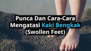 Bersihkan kaki dengan sabun seperti biasa setelah bangun dari tidur. Kaki Bengkak Penyebab Cara Mengatasinya Doctoroncall