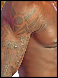 Still, no matter how advanced the technology gets, a tattoo amounts to a puncture. Keloid Scar From Tattoo Removal Tattoo Design