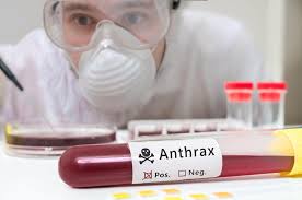 Image result for Anthrax