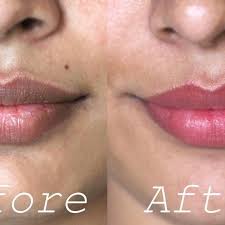 Merawat bibir agar tidak hitam dengan madu. 11 Cara Memerahkan Bibir Hitam Dengan Aman Dan Alami Ragam Bola Com