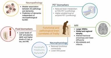 Frailty and the brain: A narrative review of functional and pathological  correlates - ScienceDirect