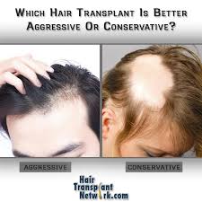 This, in turn causes hair loss. Which Hair Transplant Is Better Aggressive Or Conservative Hair Transplant Hair Loss Remedies What Causes Hair Loss