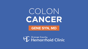 How do you know if colon cancer has spread? Colon Cancer Orange County Hemorrhoid Clinic
