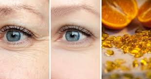 Voici Comment Utiliser La Vitamine C Sur Le Visage Pour Un Effet Botox Recette Maison En 2020 Vitamine E Botox Visage