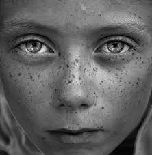 Grayscale Freckles