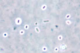 However, in recent years, there has been both an increase in the frequency and severity of r. Raoultella Planticola Nbrc 14939 Klebsiella Planticola Klebsiella Trevisanii