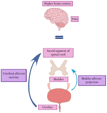 Fowlers Syndrome—The Cause of Urinary Retention in Young Women, Often  Forgotten, but Significant and Challenging to Treat