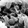 pneumonic plague from en.wikipedia.org