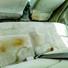 These stains are often due to sweat or heat, and can be removed fairly easily, in most cases. Https Encrypted Tbn0 Gstatic Com Images Q Tbn And9gcqofqlfc6aavadstl O6k Yv4hkeqpxmgmqscekf52ssrwcl9eu Usqp Cau