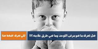 مرض التوحد أعراض مرض التوحد وأسبابه وطرق علاج مرض التوحد Supportive Treatment Movie Posters