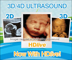 Usually, 3d and 4d ultrasounds are not covered by your health insurance, not even when it's done for medical reasons. 3d Ultrasound 4d Ultrasound Boston Chicago New York San Antonio