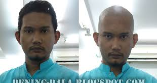 Nombor biasa onexox bukan vip. Botak Kelebihan Dan Kekurangan Hikayat Budak Pening