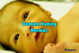 Maybe you would like to learn more about one of these? Cahaya Mata Jenis Jenis Demam Kuning Demam Kuning Facebook