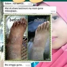 Follow jamu susuk dara on wordpress.com. Buy Jamu Susuk Dara Sabun Anggun Pesona Original Hq Free Shipping Seetracker Malaysia