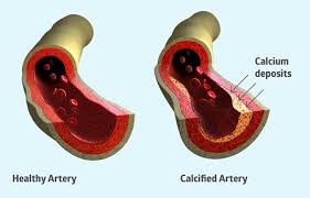 The national institutes of health reports that, while vitamin k has no known adverse effects and a low risk of becoming toxic when taken in higher doses, it can potentially interact with a variety of prescription. Vitamin K2 New Research Confirms Essential Role In Heart Health