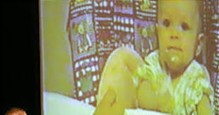 Dads of shaken tots speak out