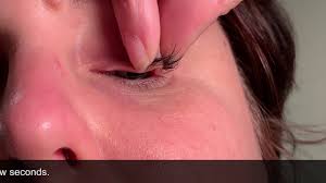 The best gifs are on giphy. Meibomian Gland Dysfunction Home Therapy Youtube