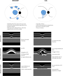 Image result for MEK Inhibitor