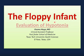 Image result for Floppy Infant