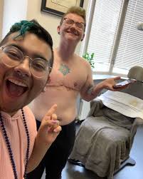 This Double Incision Top Surgery was performed by Dr. Scott Mosser.​​​​​​​​​​​​​​​​  The Double Incision procedure is the most powerful to achieve the highest  degrees of flatness and tightness of the chest. Another