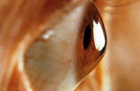 Keratoconus (irregular astigmatism) | AEI Los Angeles