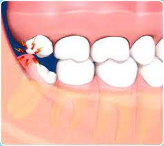 Pin On Dental Care Identalhub