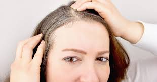 Greying of hair is a natural process. What Causes Premature Grey Hair At Young Age Reasons