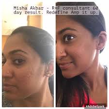 💁🏼‍♀️I like to bring this before and after out periodically just to see  the change in my skin.....that leads me to thinking about the bigger  changes Rodan and Fields has led to