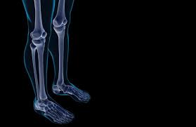 You also may feel stiffness or tenderness in the bone. Maintain Bone Health During Cancer Treatment Sanford Health News