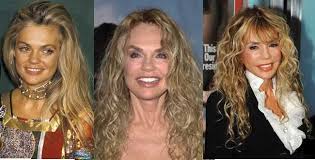 Breast implants are what must have been done to . Dyan Cannon Plastic Surgery Rumors Or Real Plastic Surgery Stars