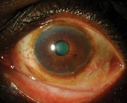 Image result for Scleria globonux