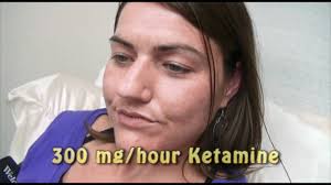 3-Day Ketamine Treatment for Complex Regional Pain Syndrome
