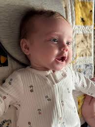 IUGR Gastroschisis survivor at 32 weeks