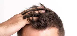 How to maintain thinning hair. 7 Excellent Natural Hair Treatments To Stop Hair Loss Immediately Adapt Nature