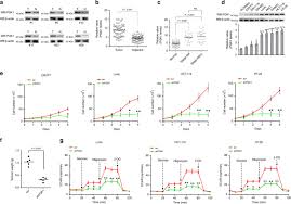 See also cancer daily horoscope and cancer monthly horoscope. O Glcnacylation Of Pgk1 Coordinates Glycolysis And Tca Cycle To Promote Tumor Growth Nature Communications