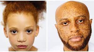 In the british isles the numbers are much higher. The Photos That Prove Not All Redheads Are White Sbs Life