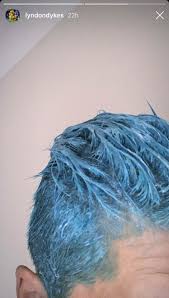 Some techniques you might like to try are simple things like scrunch drying with your head tilted. Lyndon Dykes Blue Hair Isn T A Message To Rangers It S Just Another One Of His Horrific Hairdos Insists Livingston Teammate Deadline News
