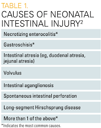 Image result for Intestinal Atresia